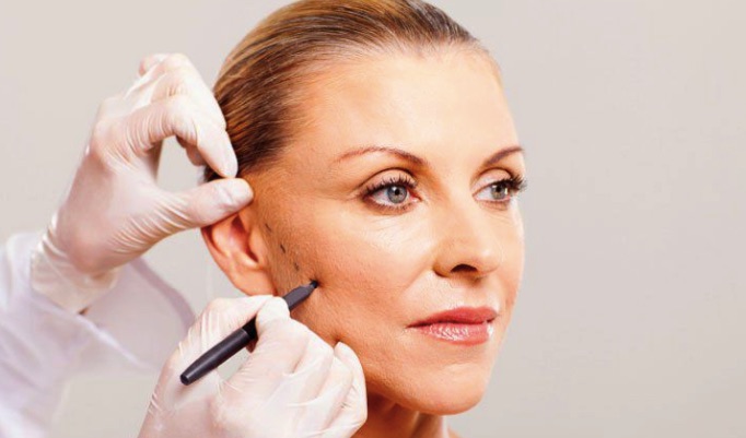 Quy trình căng da mặt bằng collagen
